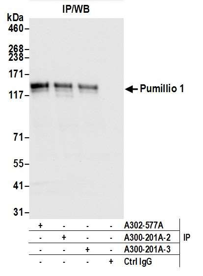 Pumilio 1 Antibody in Immunoprecipitation (IP)