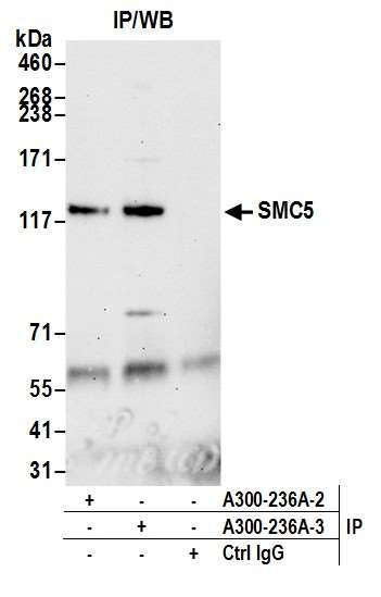 SMC5 Antibody in Immunoprecipitation (IP)