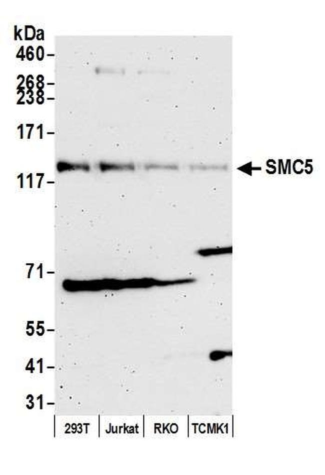 SMC5 Antibody in Western Blot (WB)