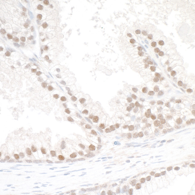 SMC6 Antibody in Immunohistochemistry (Paraffin) (IHC (P))