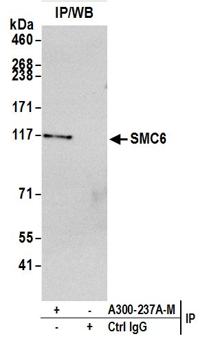 SMC6 Antibody in Immunoprecipitation (IP)