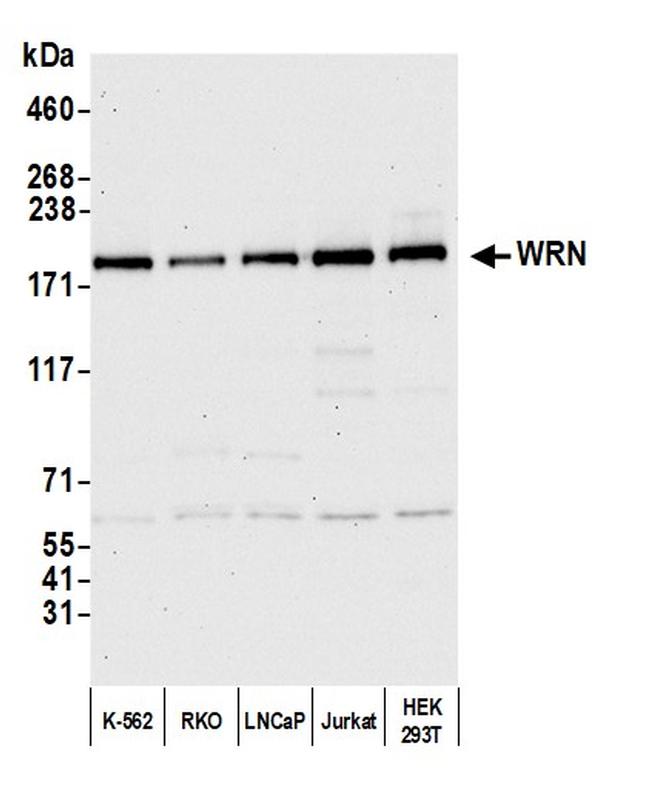 WRN Antibody in Western Blot (WB)