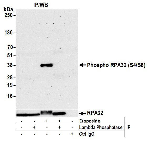 Phospho-RPA32 (Ser4, Ser8) Antibody in Immunoprecipitation (IP)