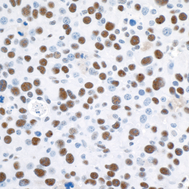 53BP1 Antibody in Immunohistochemistry (Paraffin) (IHC (P))