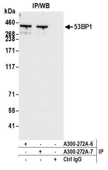 53BP1 Antibody in Immunoprecipitation (IP)