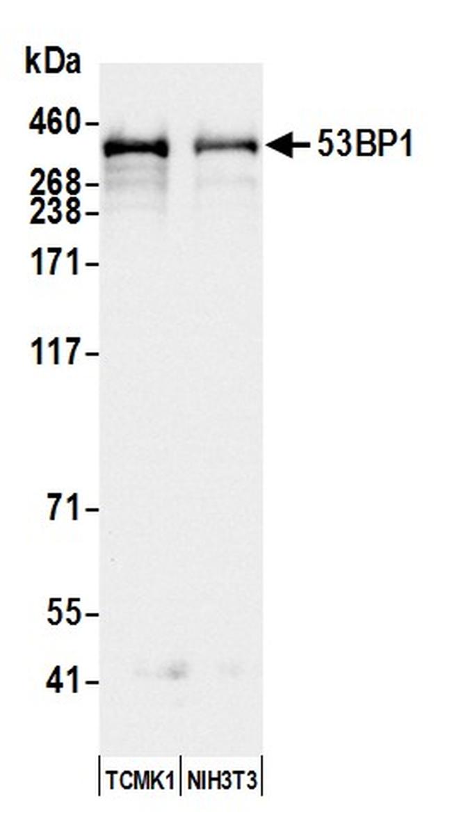 53BP1 Antibody in Western Blot (WB)