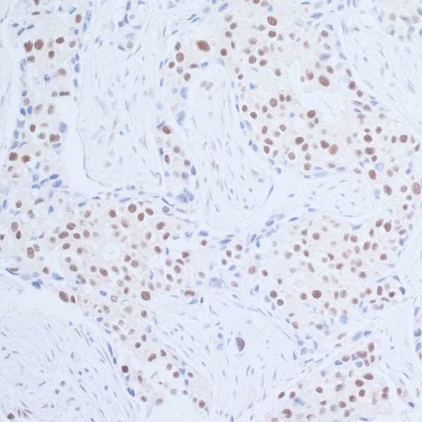 Rad6 Antibody in Immunohistochemistry (Paraffin) (IHC (P))