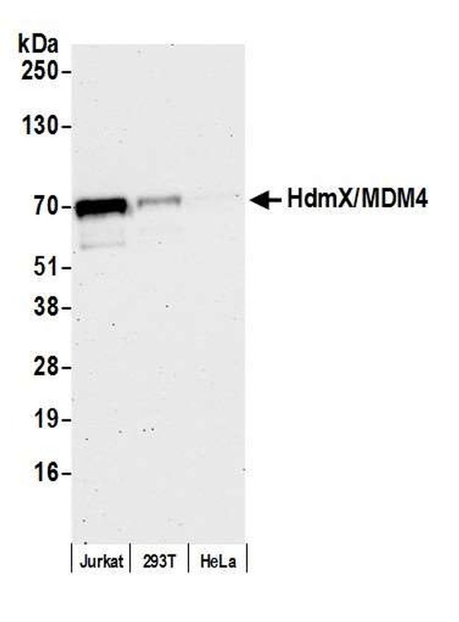 HdmX/MDM4 Antibody in Western Blot (WB)