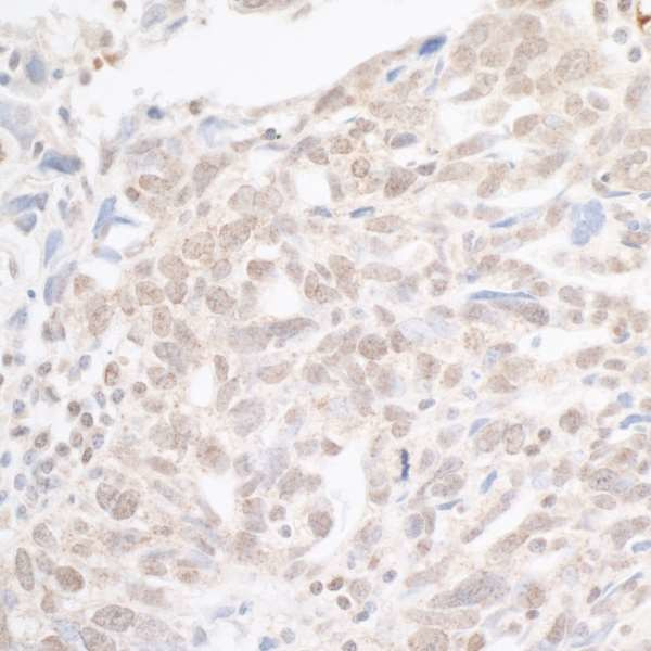 hSET1 Antibody in Immunohistochemistry (Paraffin) (IHC (P))