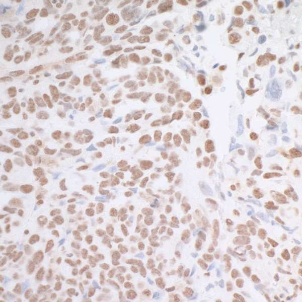 MAD2 Antibody in Immunohistochemistry (Paraffin) (IHC (P))