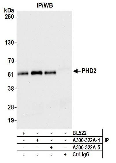 PHD2 Antibody in Immunoprecipitation (IP)