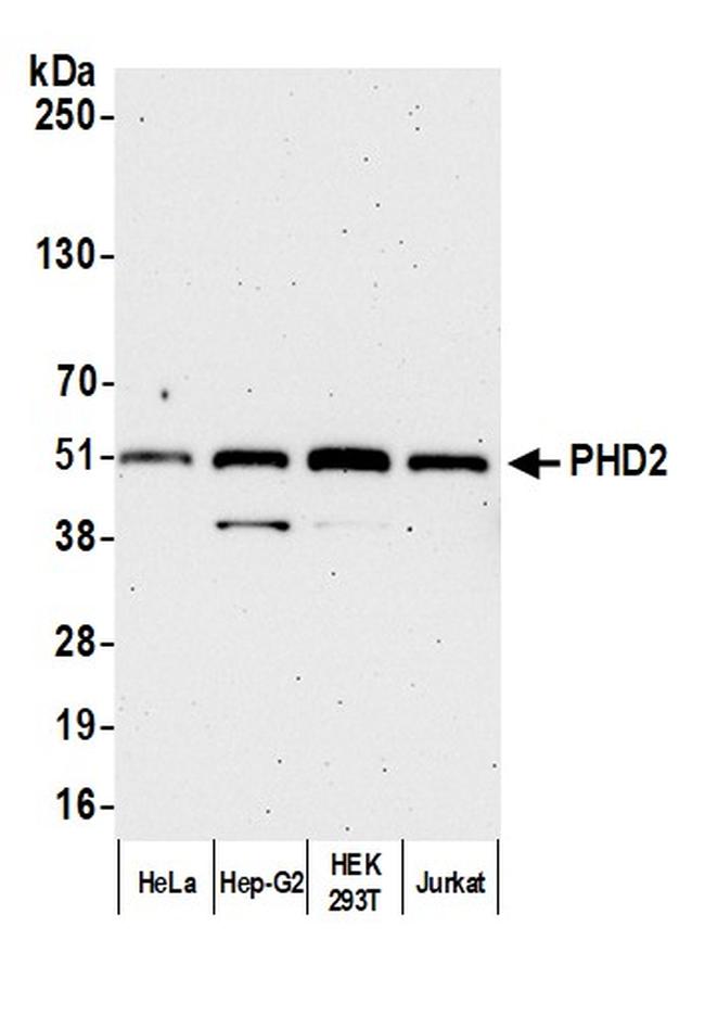 PHD2 Antibody in Western Blot (WB)