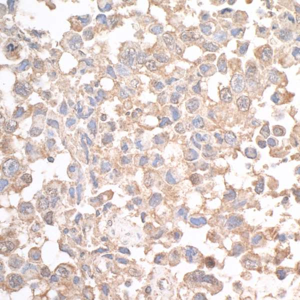 JLP Antibody in Immunohistochemistry (Paraffin) (IHC (P))