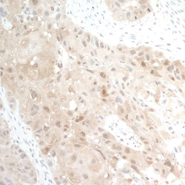 NAMPT/PBEF/Visfatin Antibody in Immunohistochemistry (Paraffin) (IHC (P))