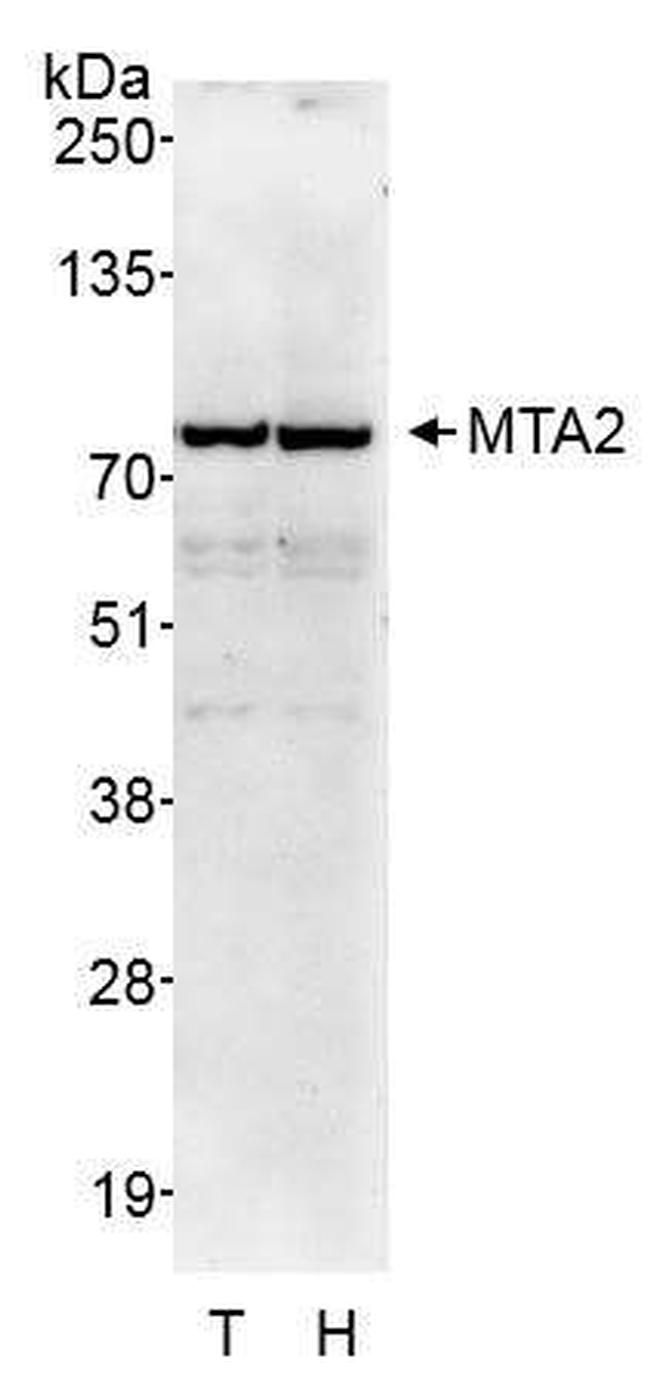 MTA2 Antibody in Western Blot (WB)