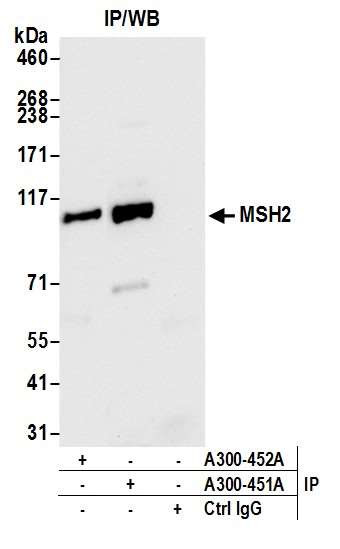 MSH2 Antibody in Immunoprecipitation (IP)