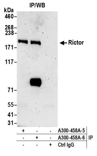 Rictor Antibody in Immunoprecipitation (IP)