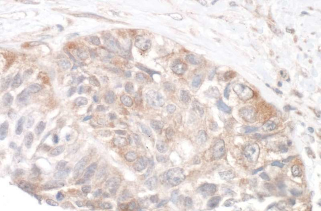 Rictor Antibody in Immunohistochemistry (Paraffin) (IHC (P))