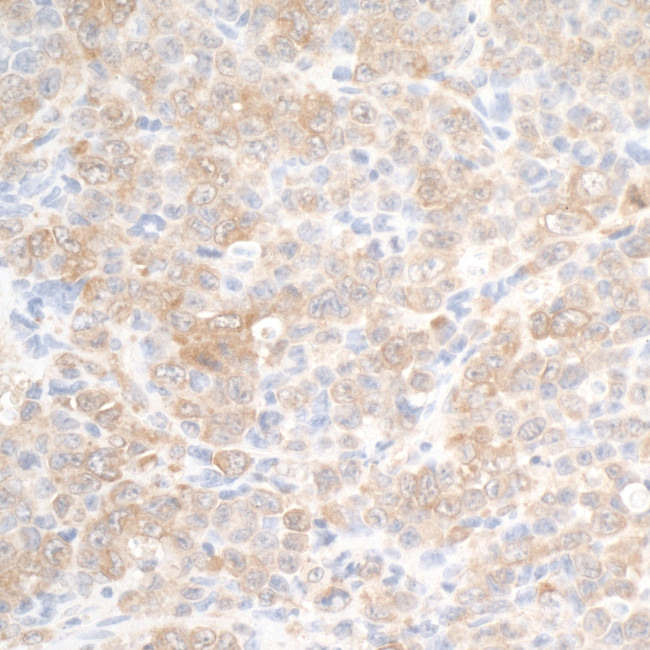 DDX3 Antibody in Immunohistochemistry (Paraffin) (IHC (P))