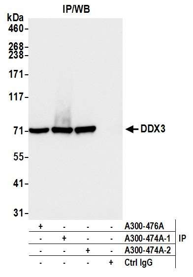 DDX3 Antibody in Immunoprecipitation (IP)