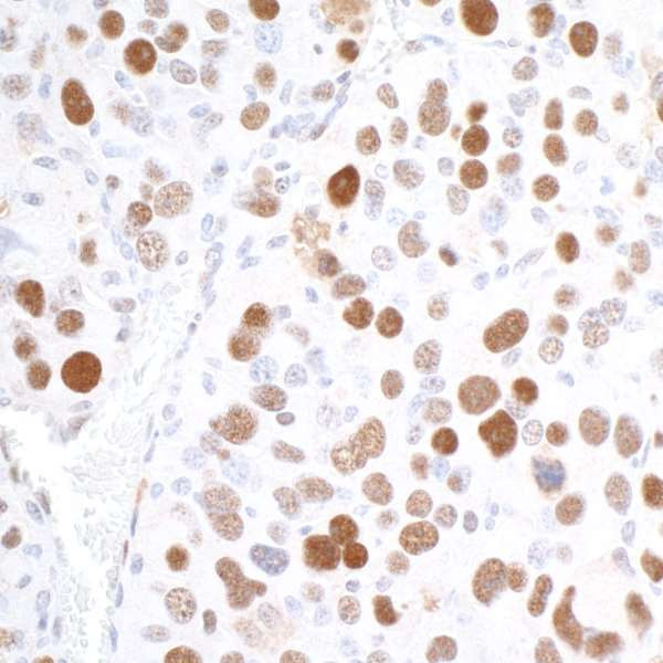 RCH1/KPNA2 Antibody in Immunohistochemistry (Paraffin) (IHC (P))