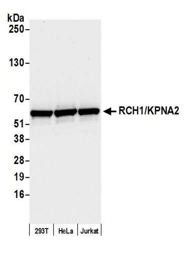 RCH1/KPNA2 Antibody in Western Blot (WB)