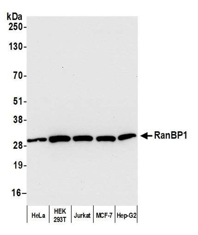 RanBP1 Antibody in Western Blot (WB)