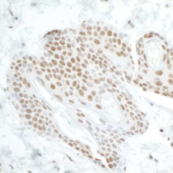 DDX5 Antibody in Immunohistochemistry (Paraffin) (IHC (P))