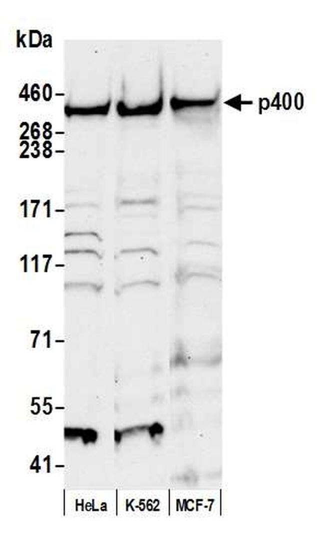 p400 Antibody in Western Blot (WB)