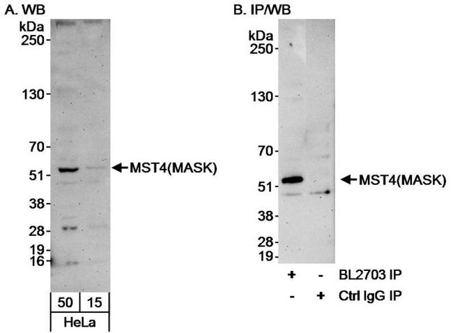 MST4/MASK Antibody in Western Blot (WB)