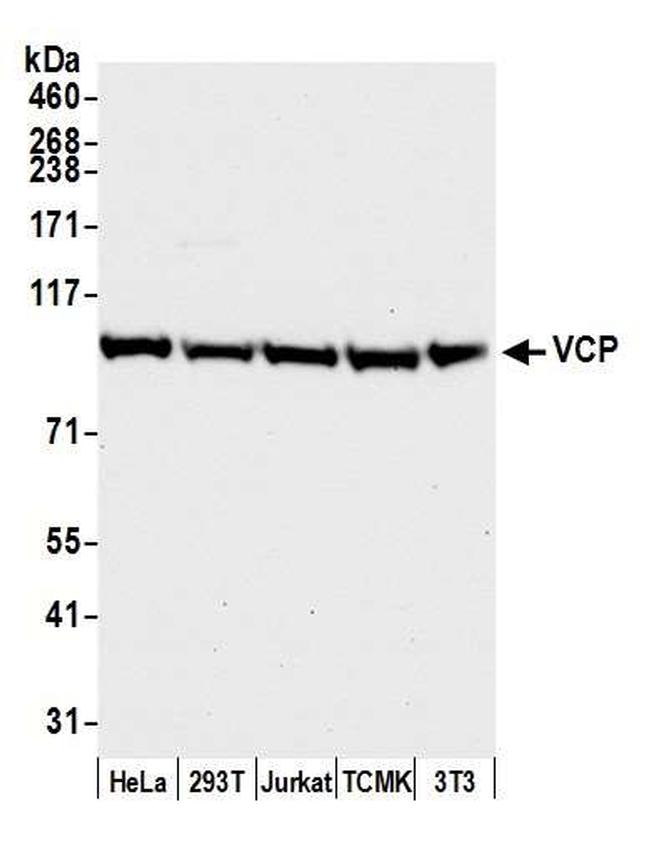 VCP Antibody in Western Blot (WB)