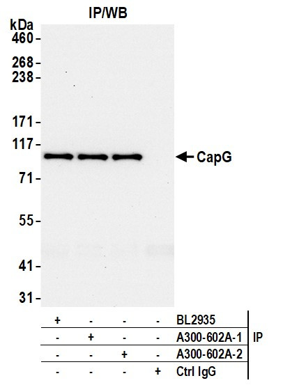 CAP-G Antibody in Immunoprecipitation (IP)