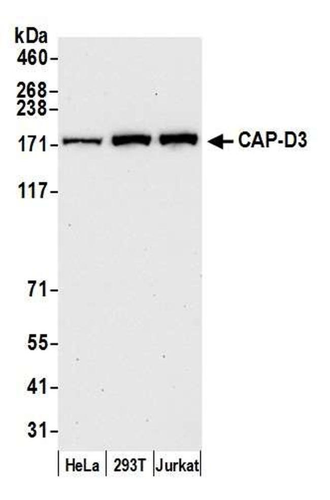 CAP-D3 Antibody in Western Blot (WB)