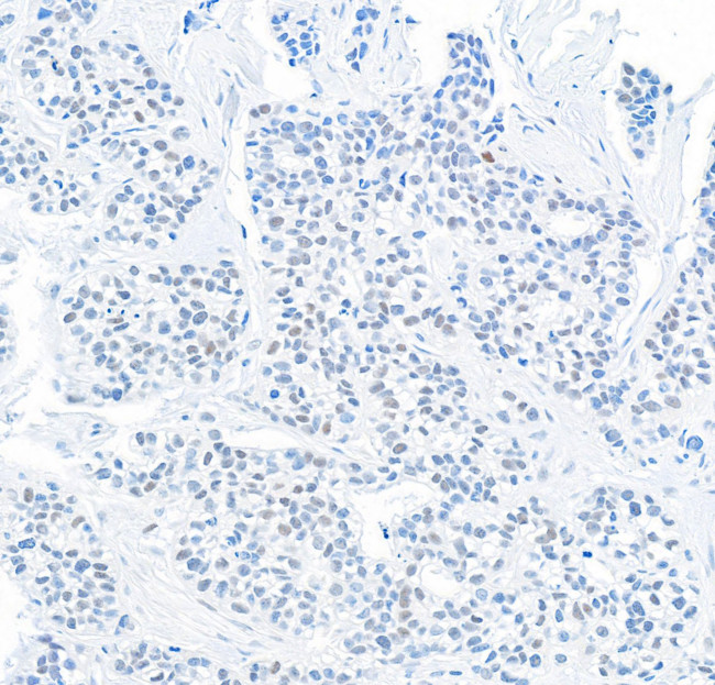 DEC1 Antibody in Immunohistochemistry (Paraffin) (IHC (P))