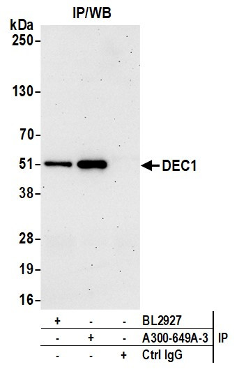 DEC1 Antibody in Immunoprecipitation (IP)