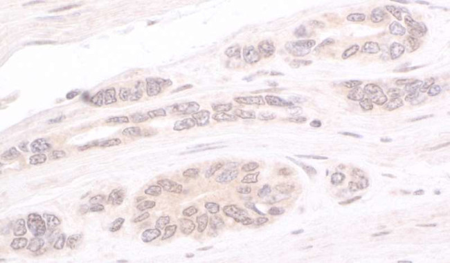 ATRIP Antibody in Immunohistochemistry (Paraffin) (IHC (P))