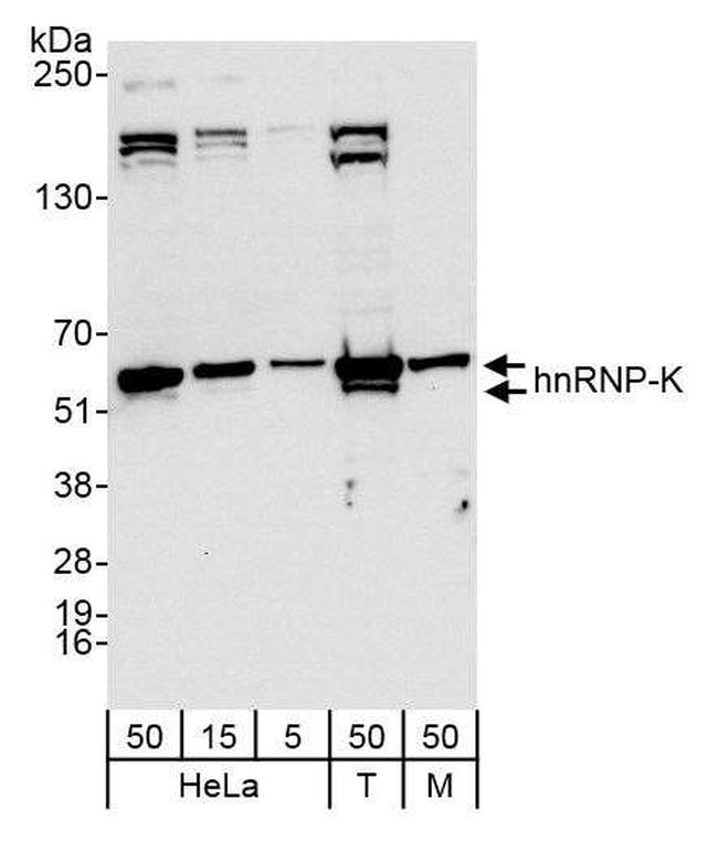 hnRNP-K Antibody in Western Blot (WB)