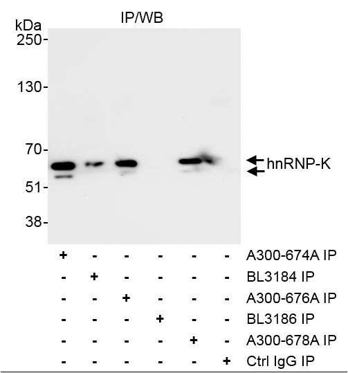 hnRNP-K Antibody in Immunoprecipitation (IP)