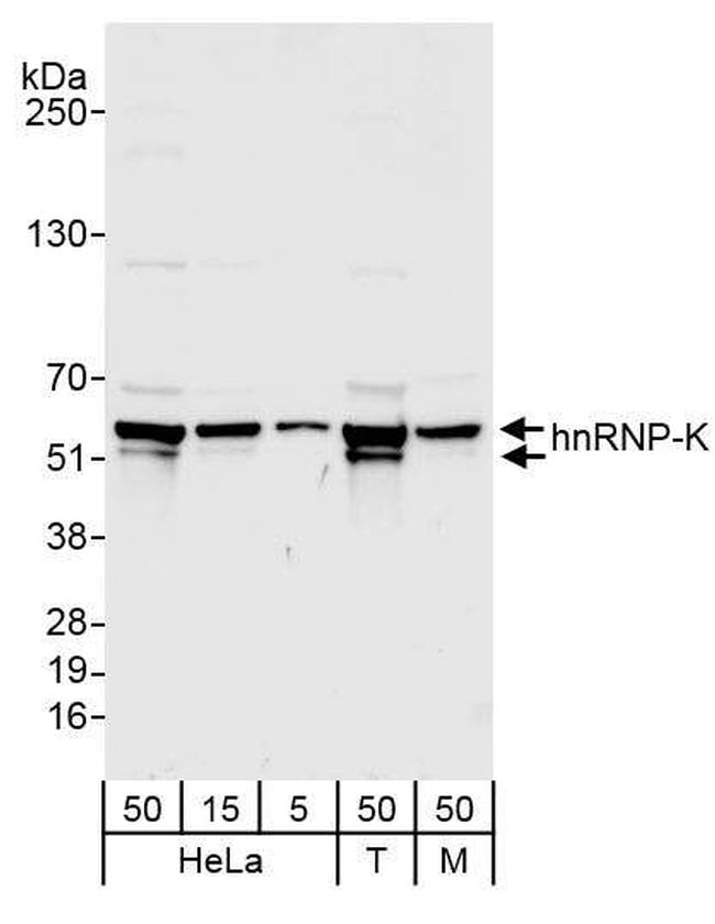 hnRNP-K Antibody in Western Blot (WB)