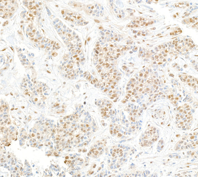 Cul4a Antibody in Immunohistochemistry (Paraffin) (IHC (P))