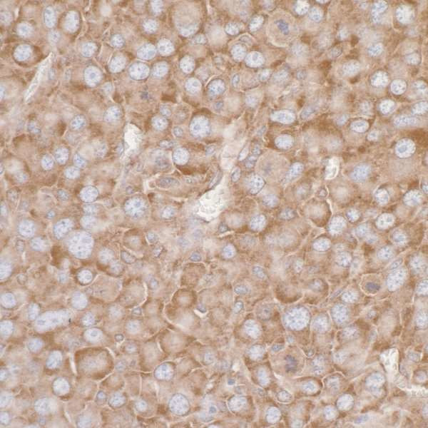 RPL7 Antibody in Immunohistochemistry (Paraffin) (IHC (P))