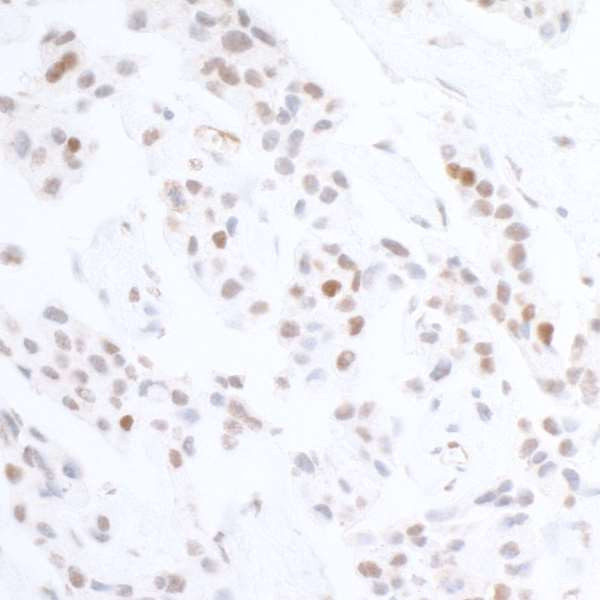 Phospho-KAP-1 (Ser824) Antibody in Immunohistochemistry (Paraffin) (IHC (P))