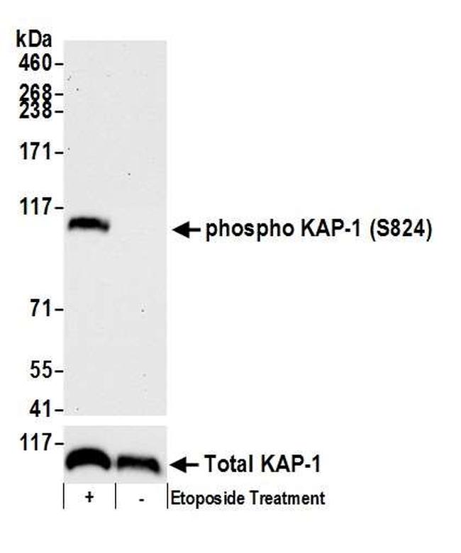 Phospho-KAP-1 (Ser824) Antibody in Western Blot (WB)