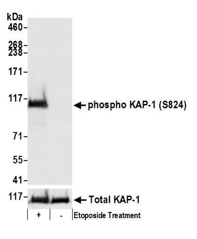 Phospho-KAP-1 (Ser824) Antibody in Western Blot (WB)