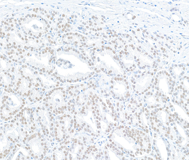 MED12 Antibody in Immunohistochemistry (Paraffin) (IHC (P))