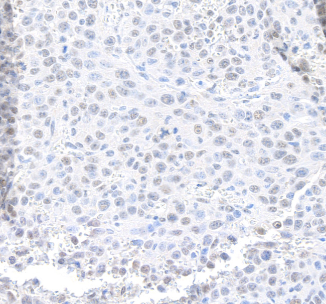 MED12 Antibody in Immunohistochemistry (Paraffin) (IHC (P))