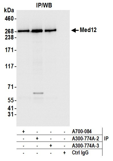 MED12 Antibody in Immunoprecipitation (IP)