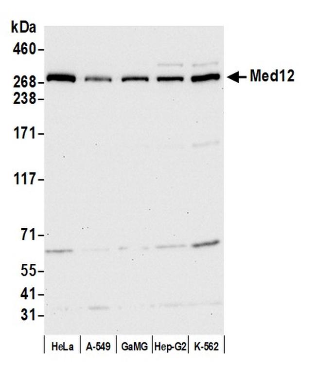 MED12 Antibody in Western Blot (WB)