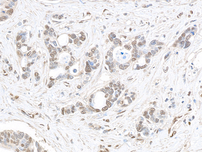 CRSP1/TRAP220 Antibody in Immunohistochemistry (Paraffin) (IHC (P))