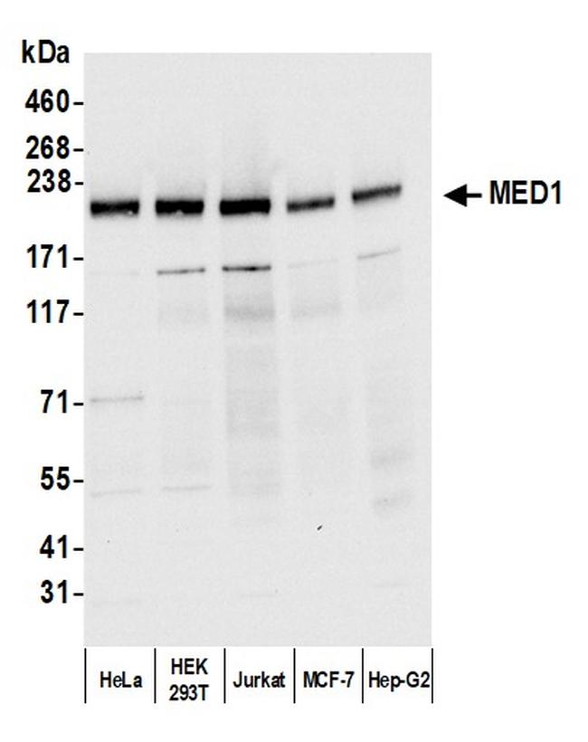 CRSP1/TRAP220 Antibody in Western Blot (WB)